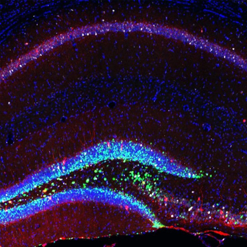 Stammzellen verbessern das Gedächtnis von alten Mäusen